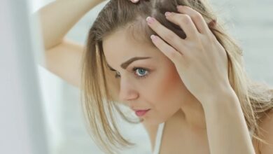 Why Homeopathic Medicine for Hair Loss- You Should Know